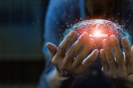 Alzheimer and 58 Resveratrol Trials