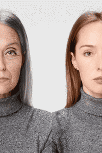 Resveratrol as Anti-aging Antioxidant