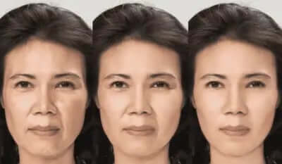 Japanese Reverse Aging Process in cells and challenges a long standing Theory of Aging