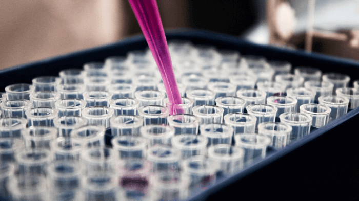Why Are CBD Test Results So Important For Consumers?
