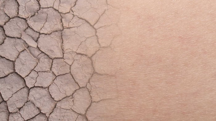 Gesichtspflege für extrem trockene Haut