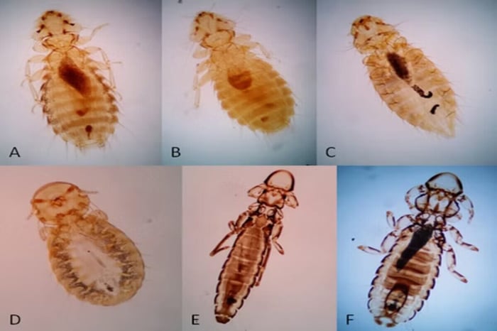 Chicken Lice