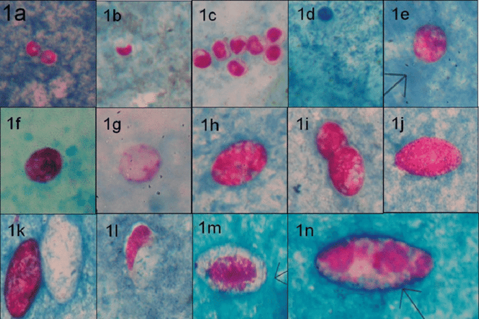 Coccidia Parasites