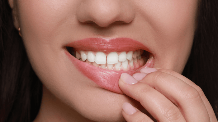 What Triggers Itchy Gums After Flossing?