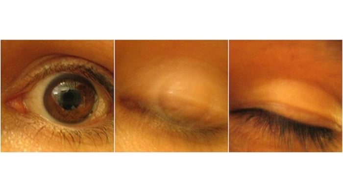 Architectural Design for the Human Eye