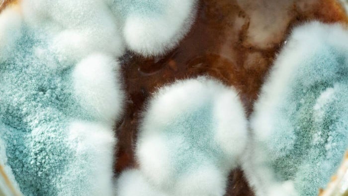 Aspergillosis