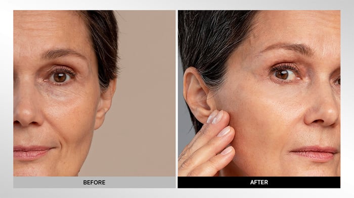 Anti-wrinkle effect of facial mask