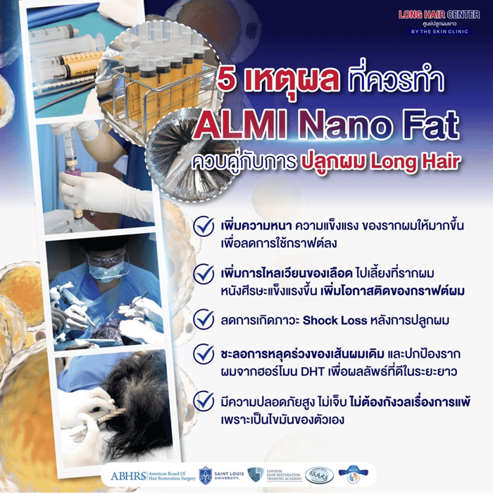 เคสจริง! แพทย์จากออสเตรเลียบินตรงมาปลูกผมกับหมอท๊อป ด้วยเทคนิค Long Hair x ALMI Nano Fat