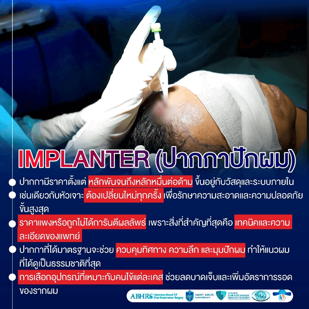 ปลูกผมราคาถูก vs ปลูกผมราคาแพง ต่างกันยังไง? เลือกแบบไหนไม่พลาด