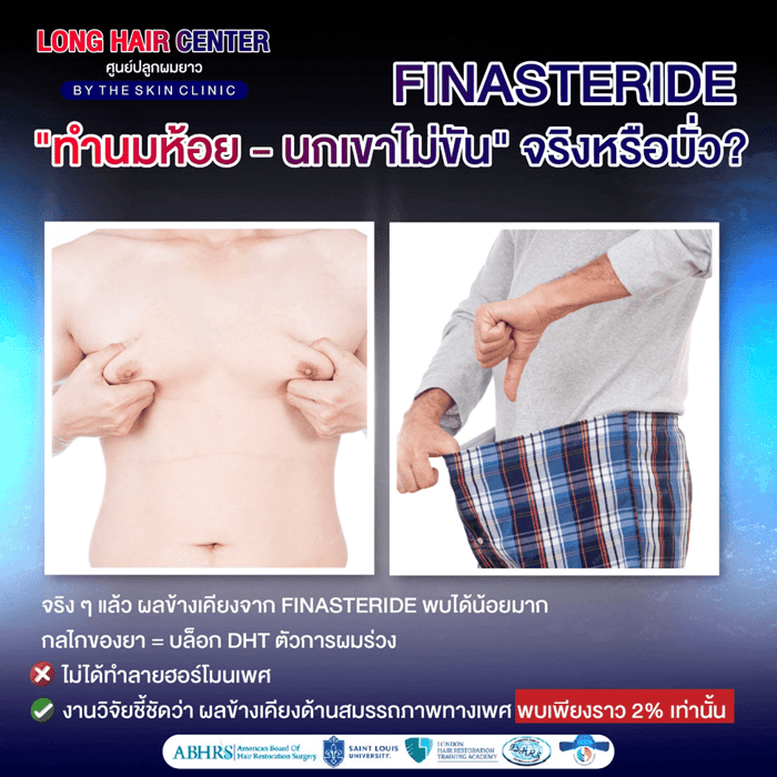 10 เรื่องลับเกี่ยวกับ Finasteride และ Minoxidil: ความจริง vs ความเชื่อผิดๆ 