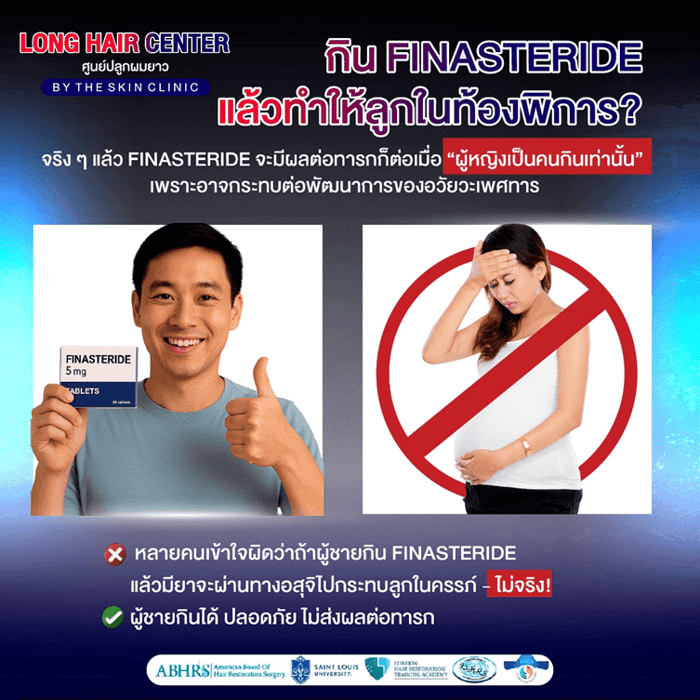 10 เรื่องลับเกี่ยวกับ Finasteride และ Minoxidil: ความจริง vs ความเชื่อผิดๆ 