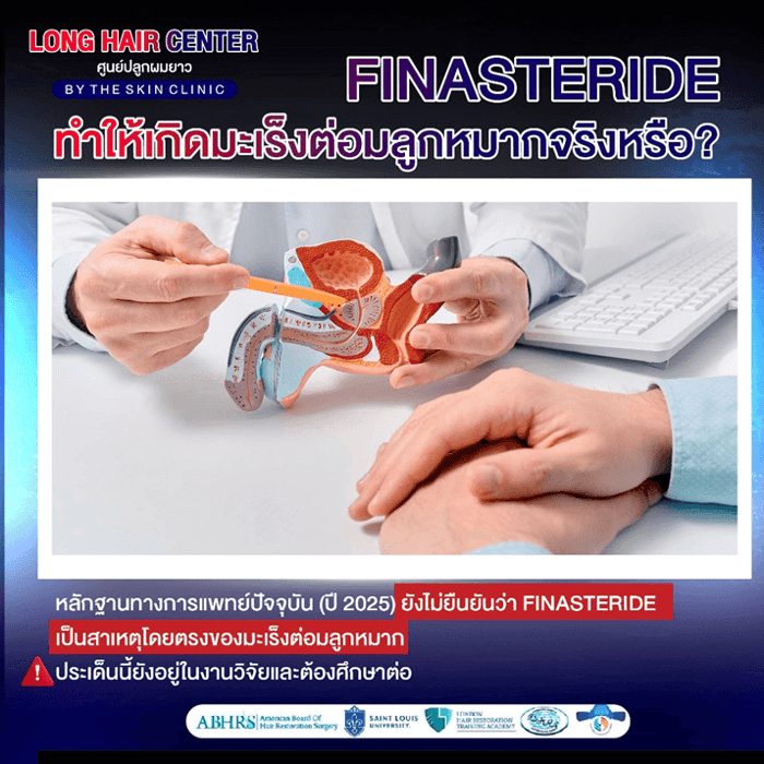 10 เรื่องลับเกี่ยวกับ Finasteride และ Minoxidil: ความจริง vs ความเชื่อผิดๆ 