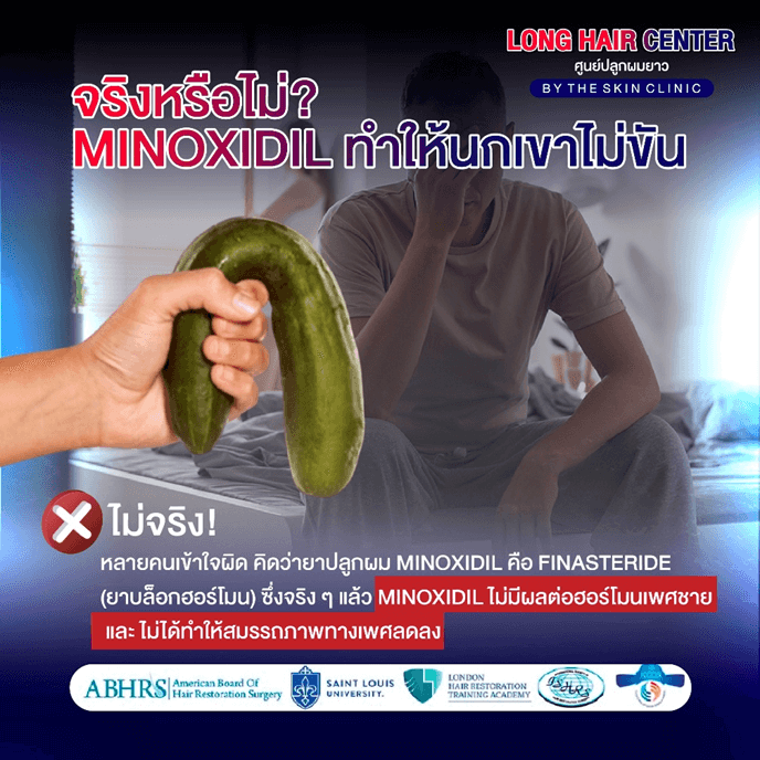 10 เรื่องลับเกี่ยวกับ Finasteride และ Minoxidil: ความจริง vs ความเชื่อผิดๆ 