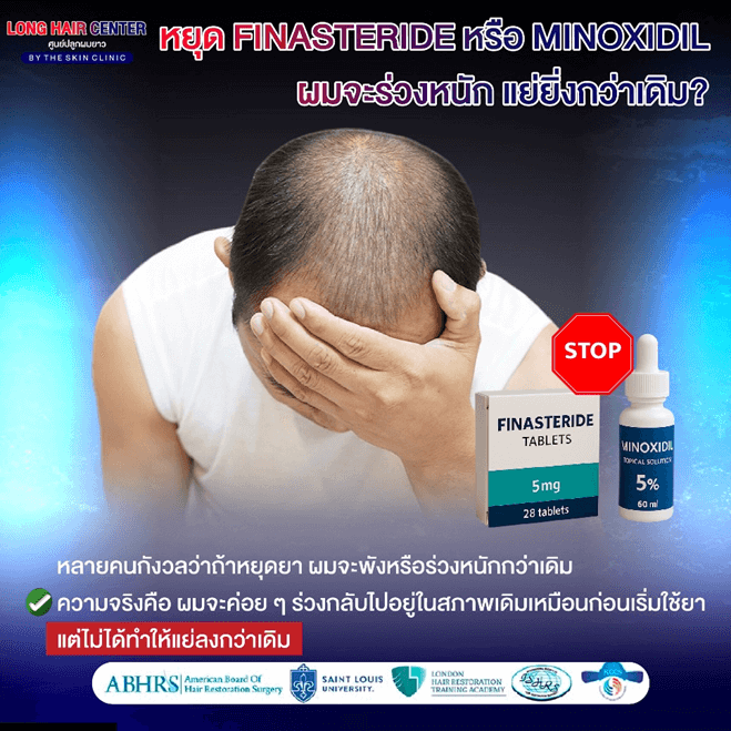 10 เรื่องลับเกี่ยวกับ Finasteride และ Minoxidil: ความจริง vs ความเชื่อผิดๆ 
