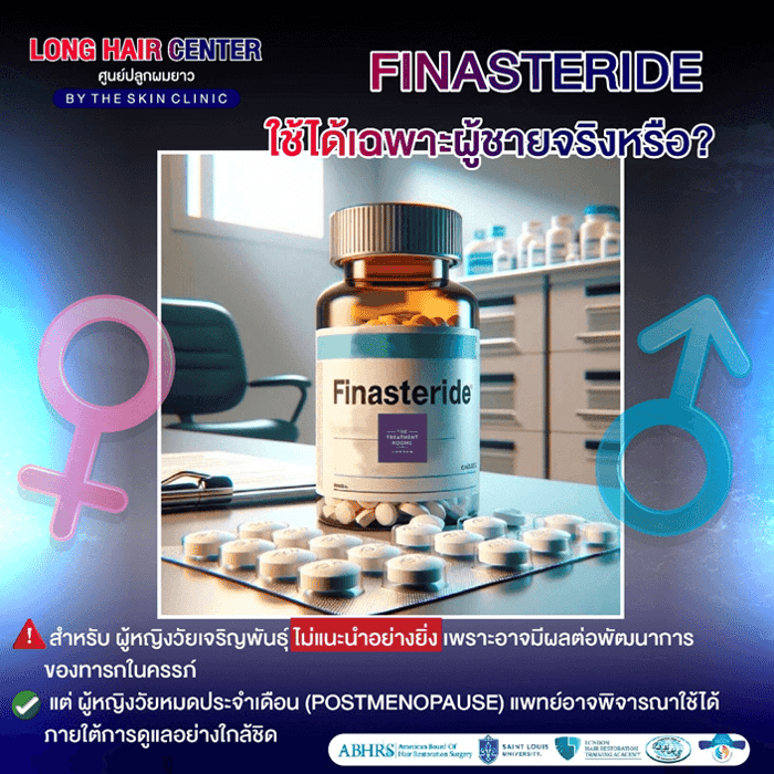 10 เรื่องลับเกี่ยวกับ Finasteride และ Minoxidil: ความจริง vs ความเชื่อผิดๆ 