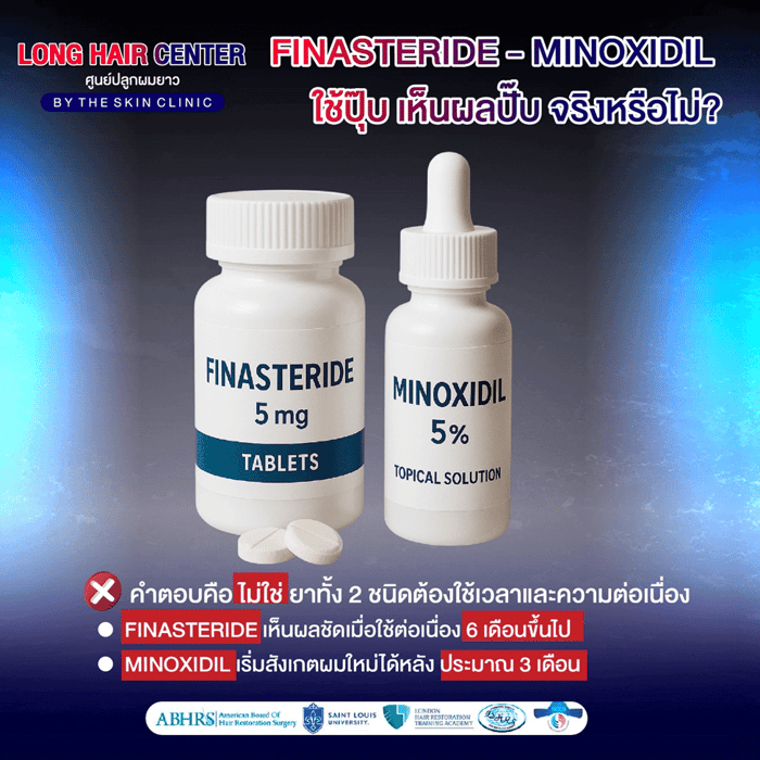 10 เรื่องลับเกี่ยวกับ Finasteride และ Minoxidil: ความจริง vs ความเชื่อผิดๆ 