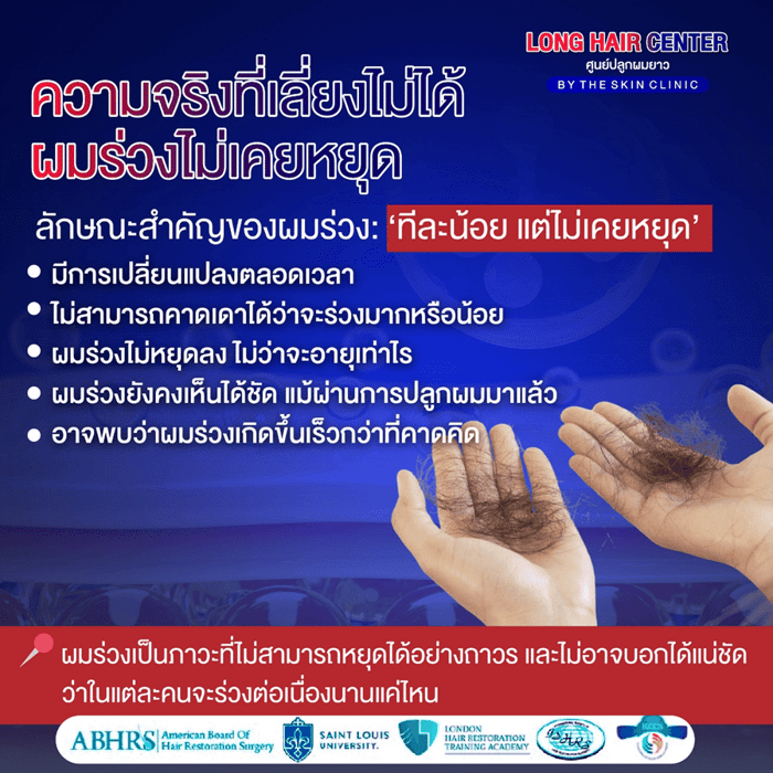 นวัตกรรมเทคนิคใหม่ของวงการปลูกผม รักษาผมบางด้วยนาโนแฟต (Nano Fat)