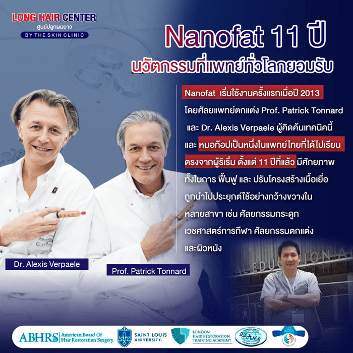 นวัตกรรมเทคนิคใหม่ของวงการปลูกผม รักษาผมบางด้วยนาโนแฟต (Nano Fat)