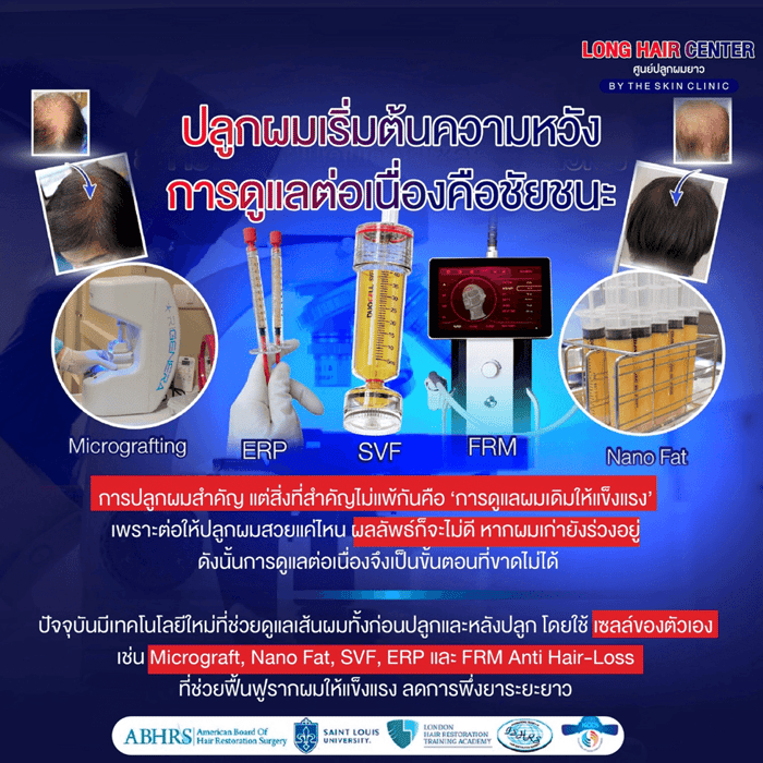 Regenerative Medicine ที่น่าจับตามองในตอนนี้ มีเทคนิคอะไรบ้าง?