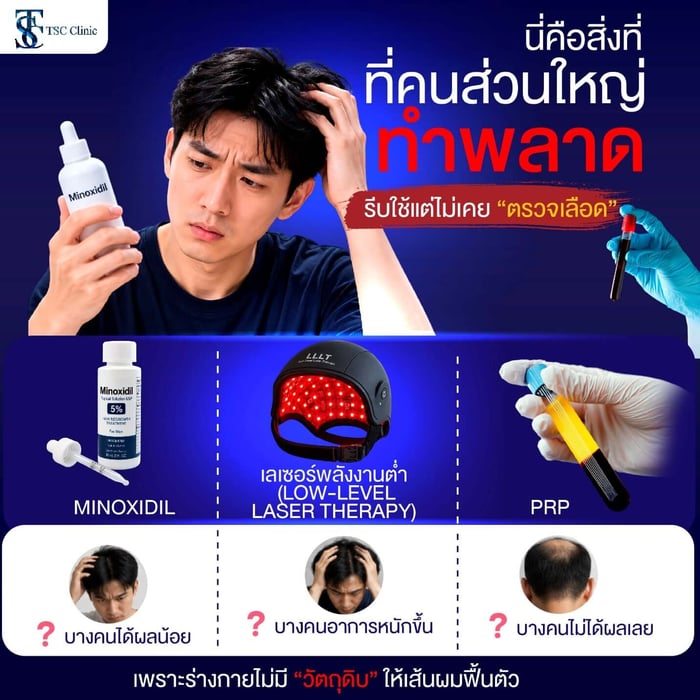 สาเหตุผมร่วง