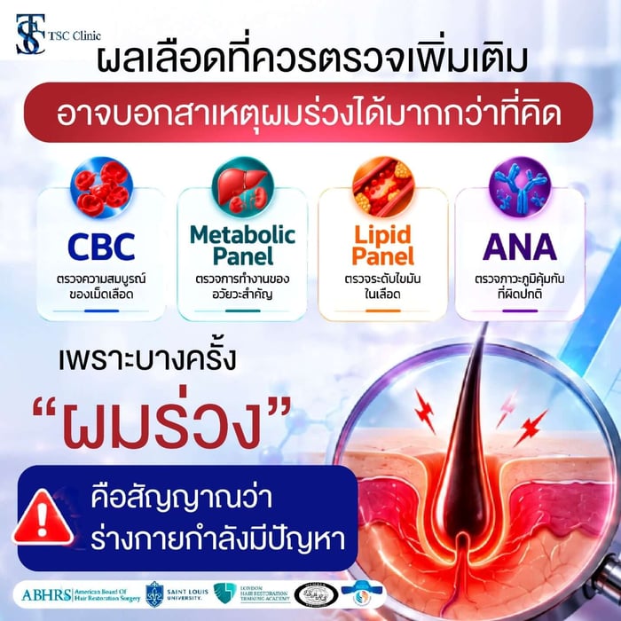 สาเหตุผมร่วง