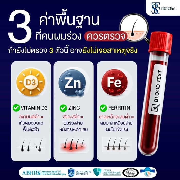 สาเหตุผมร่วง