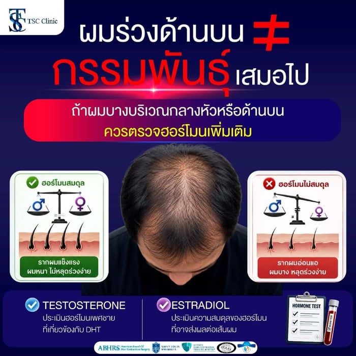 สาเหตุผมร่วง