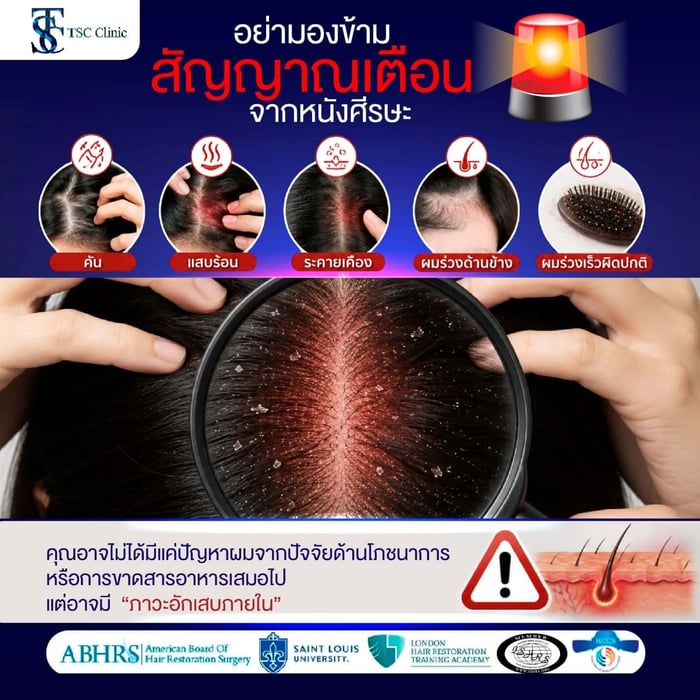 สาเหตุผมร่วง