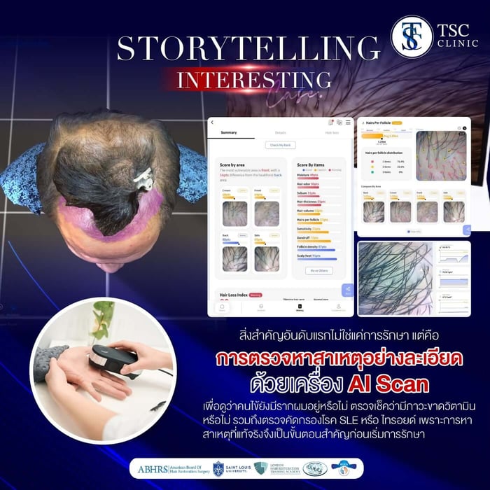 สาเหตุผมร่วง