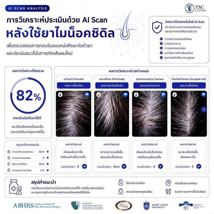 ภาพตัวอย่างผลการวิเคราห์ประเมินด้วย AI Scan หลังใช้ยาไมน็อควิดิล