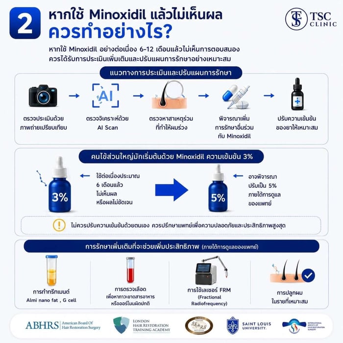 ภาพสรุปหัวข้อ หากใช้ Minoxidil แล้วไม่เห็นผล ควรทำอย่างไร?