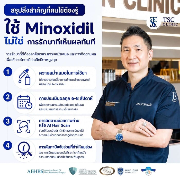 สรุปสิ่งสำคัญที่คนใช้ Minoxidil ต้องรู้ ใช้ Minoxidil ไม่ใช่ การรักษาที่เห็นผลทันที