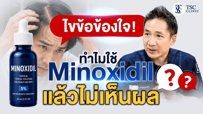 ปกวิดีโอ "ไขข้อข้องใจ! ทำไมใช้ Minoxidil แล้วไม่เห็นผล?"