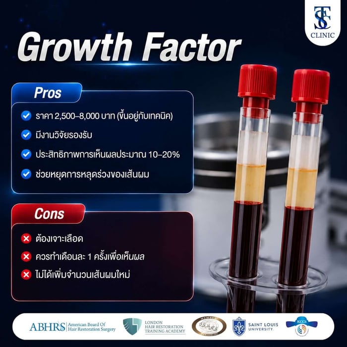 Growth Factor