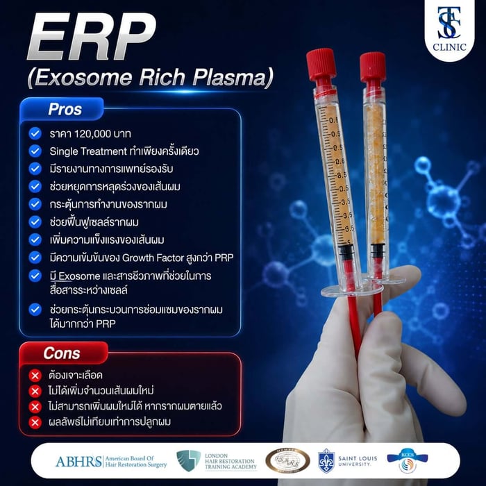 ERP (Exosome Rich Plasma)