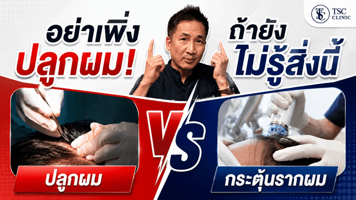 ภาพปกวิดีโอ "อย่าเพิ่งปลูกผมถ้ายังไม่รู้สิ่งนี้"