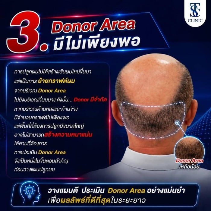 Donor Area มีไม่เพียงพอ