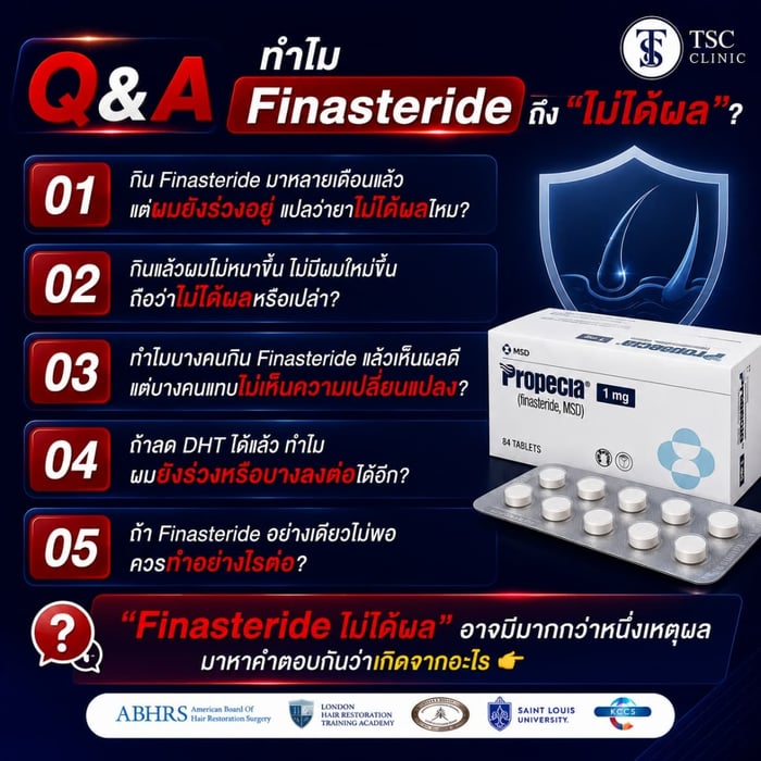 ทำไม Finasteride ถึง “ไม่ได้ผล” ?