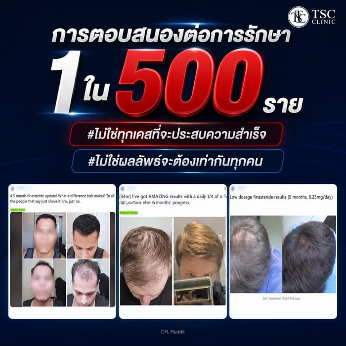 การตอบสนองต่อการรักษา 1 ใน 500 ราย #ไม่ใช่ทุกเคสที่จะประสบความสำเร็จ #ไม่ใช่ผลลัพธ์จะต้องเท่ากันทุกคน