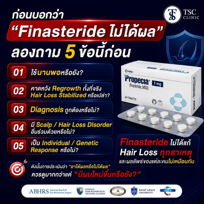 ก่อนบอกว่า "Finasteride ไม่ได้ผล" ลองถาม 5 ข้อนี้ก่อน