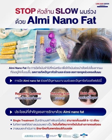 ปลูกผมที่ไหนดี, ศัลยกรรมปลูกผม