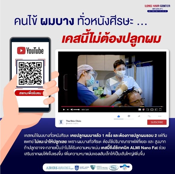 ปลูกผม ราคาเท่าไหร่, ปลูกผมที่ไหนดี