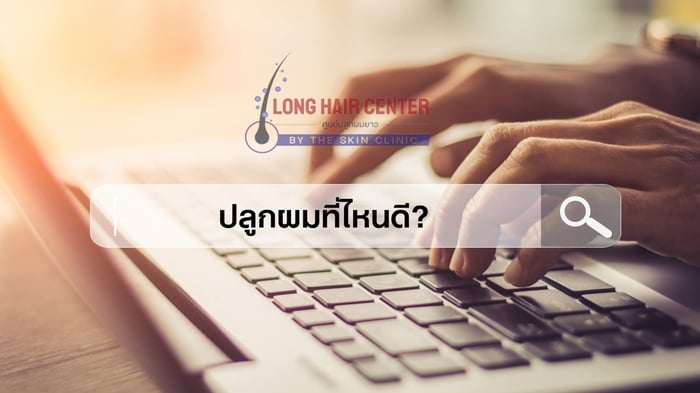 ทำไมต้องหาข้อมูลให้มาก ก่อนตัดสินใจปลูกผม?