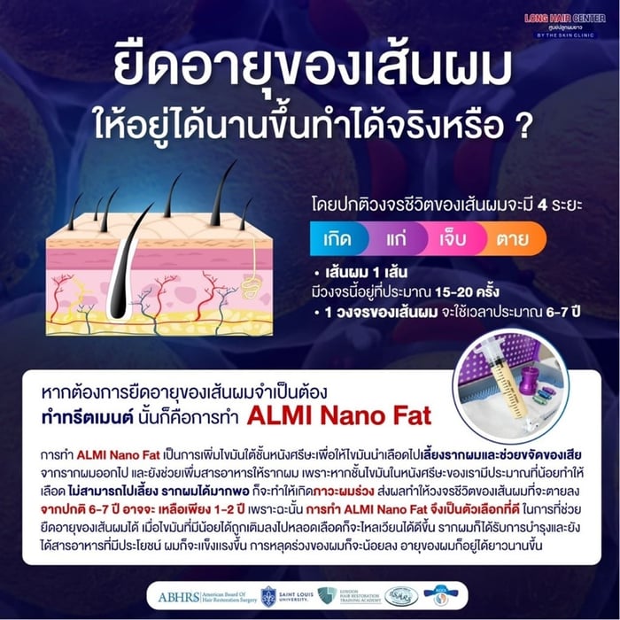 ในอนาคตจะต้องปลูกผมเพิ่มไหม?