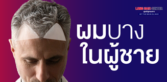 ตำแหน่งที่เกิดผมบางมักเป็นบริเวณกลางศีรษะ พบได้ 2 ใน 3 ของเพศชาย อีกบริเวณคือหน้าผาก หากเป็นทั้งสองตำแหน่งร่วมกันจะเสี่ยงต่อศีรษะล้านได้มากขึ้น