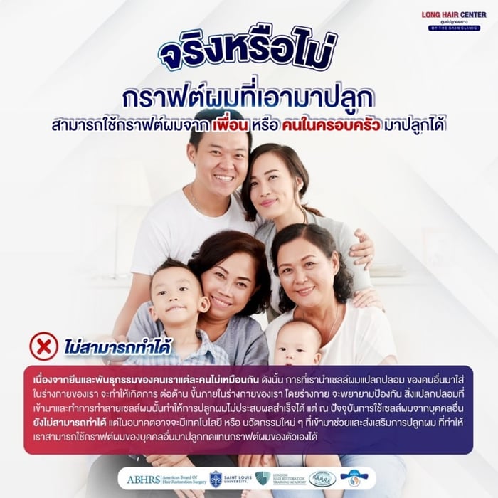 เหตุผลที่ไม่สามารถปลูกผมด้วยเส้นผมของคนอื่นได้