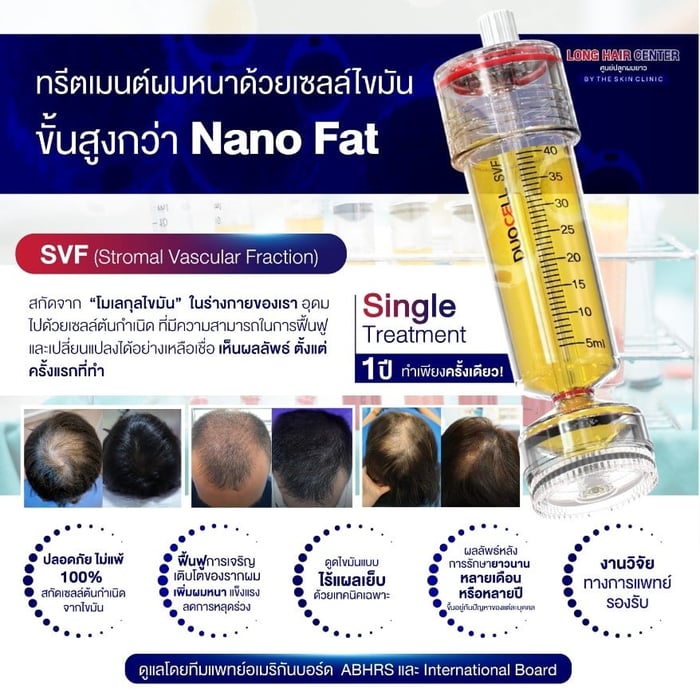 SVF (Stromal Vascular Fraction)