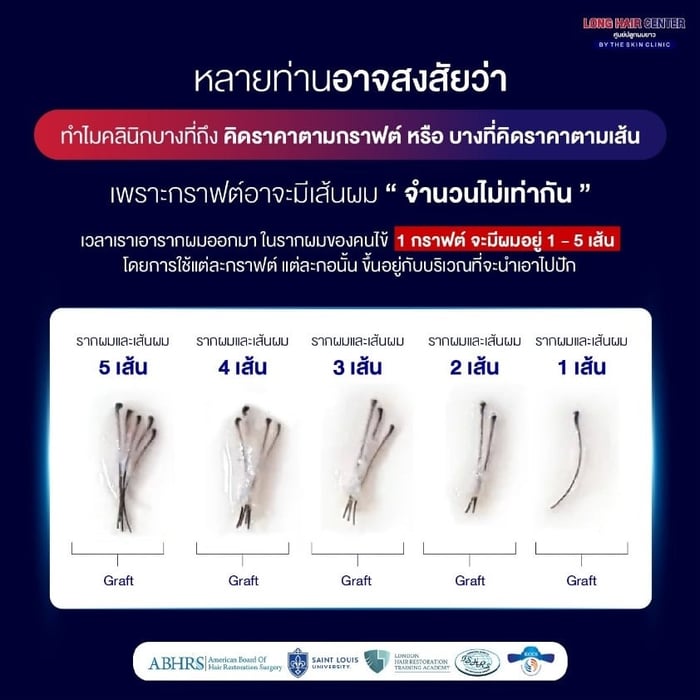 ศัลยกรรมปลูกผม, คลินิกปลูกผม