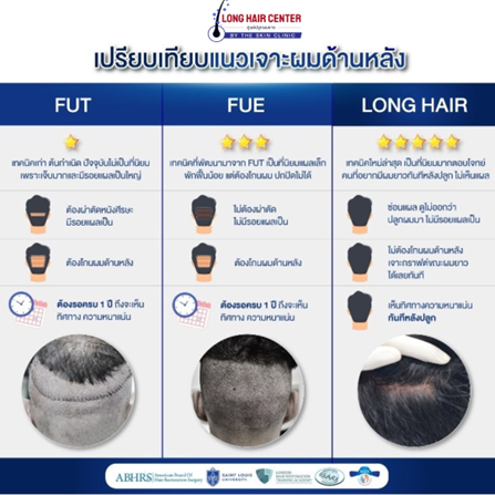 รอยแผลเป็นหลังการปลูกผมขึ้นอยู่กับอะไรบ้าง?