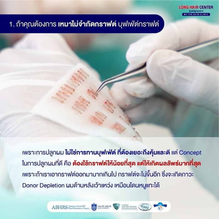 ต้องการปลูกผมแบบเหมากราฟต์ ไม่จำกัดจำนวนกราฟต์ 